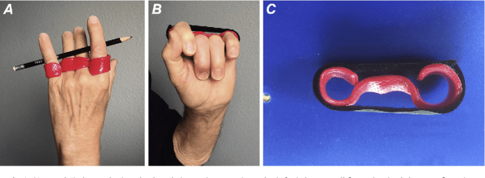 Yoke splint for middle finger