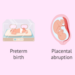 Ati reproduction complications of pregnancy