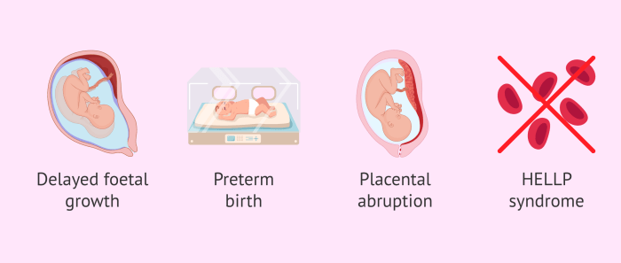 Ati reproduction complications of pregnancy